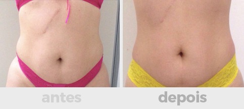 a8503005-ab3d-4d0c-9087-e24c7556dced